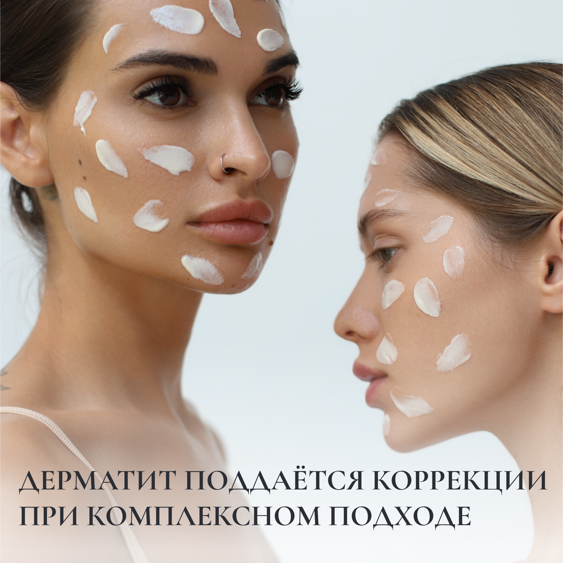 ДЕРМАТИТ ПОДДАЁТСЯ КОРРЕКЦИИ ПРИ КОМПЛЕКСНОМ ПОДХОДЕ