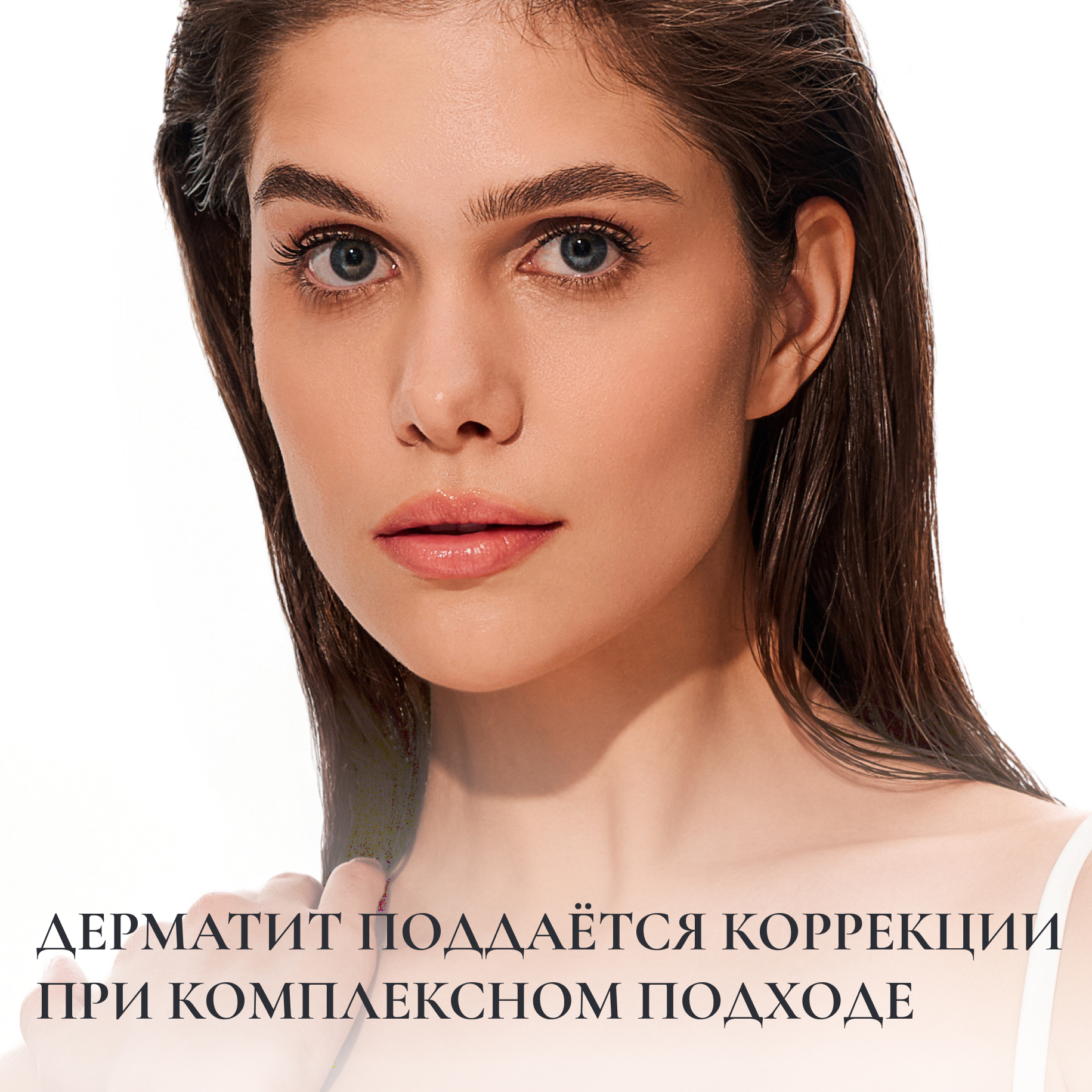 ДЕРМАТИТ ПОДДАЁТСЯ КОРРЕКЦИИ ПРИ КОМПЛЕКСНОМ ПОДХОДЕ