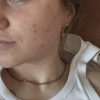 Гель для умывания противовоспалительный